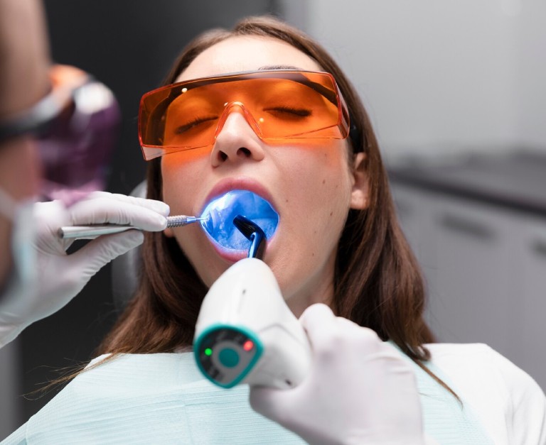 Composite-Fillings